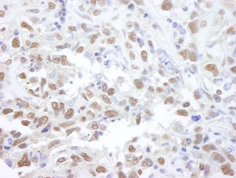 PPP4C Antibody (aa1-50)