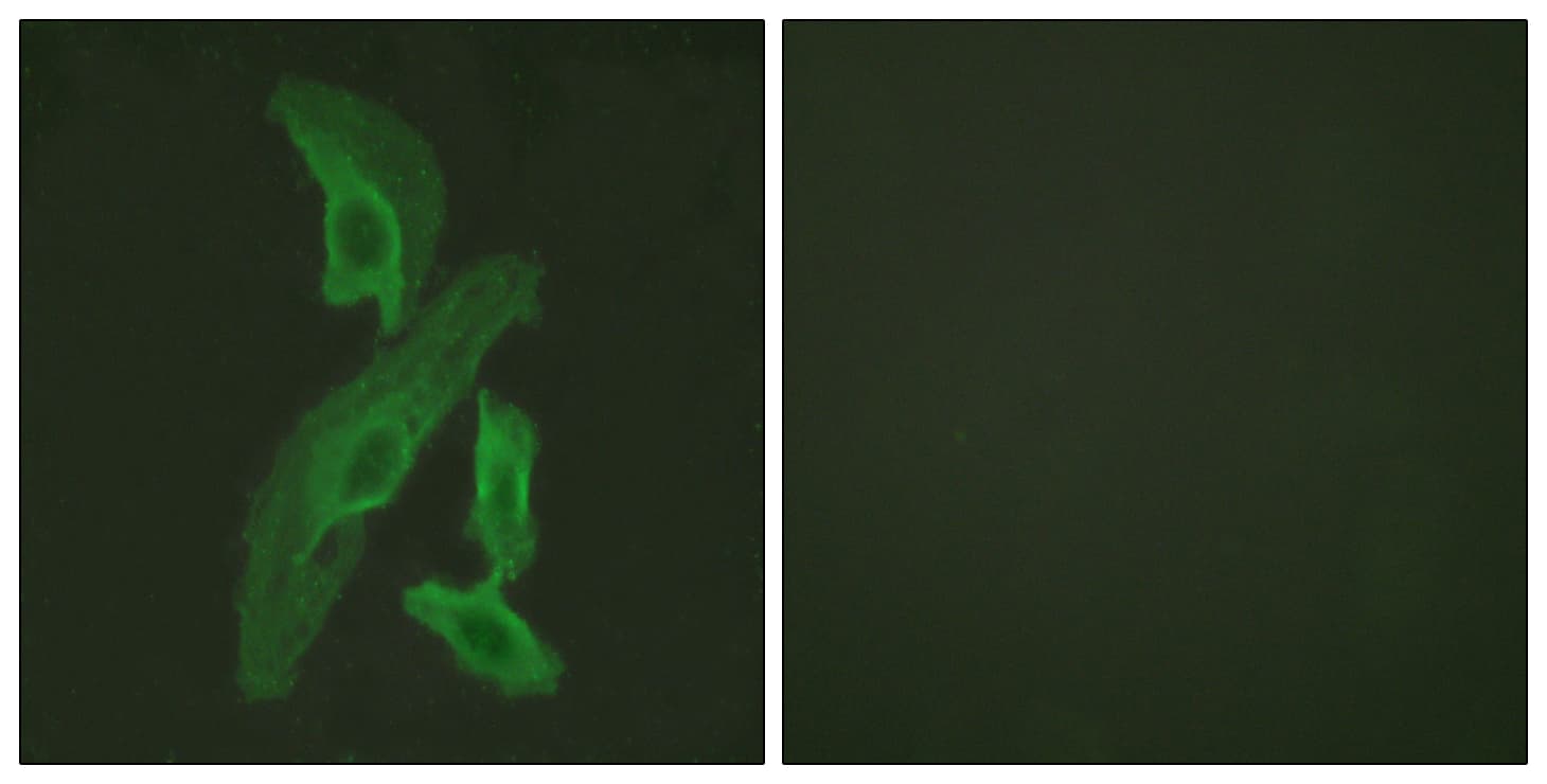 BCL2L1 / BCL-XL Antibody (aa13-62)