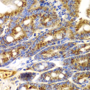 TNFSF11 / RANKL / TRANCE Antibody