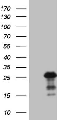 Monoclonal Mouse anti-Human BMF Antibody (clone OTI6F3, IHC, WB)