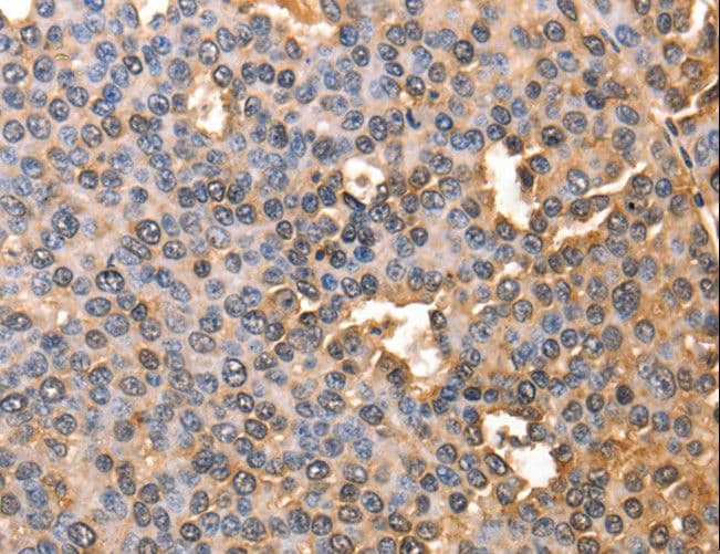 Polyclonal Rabbit anti-Human Alpha-Fetoprotein Antibody (IHC, WB)