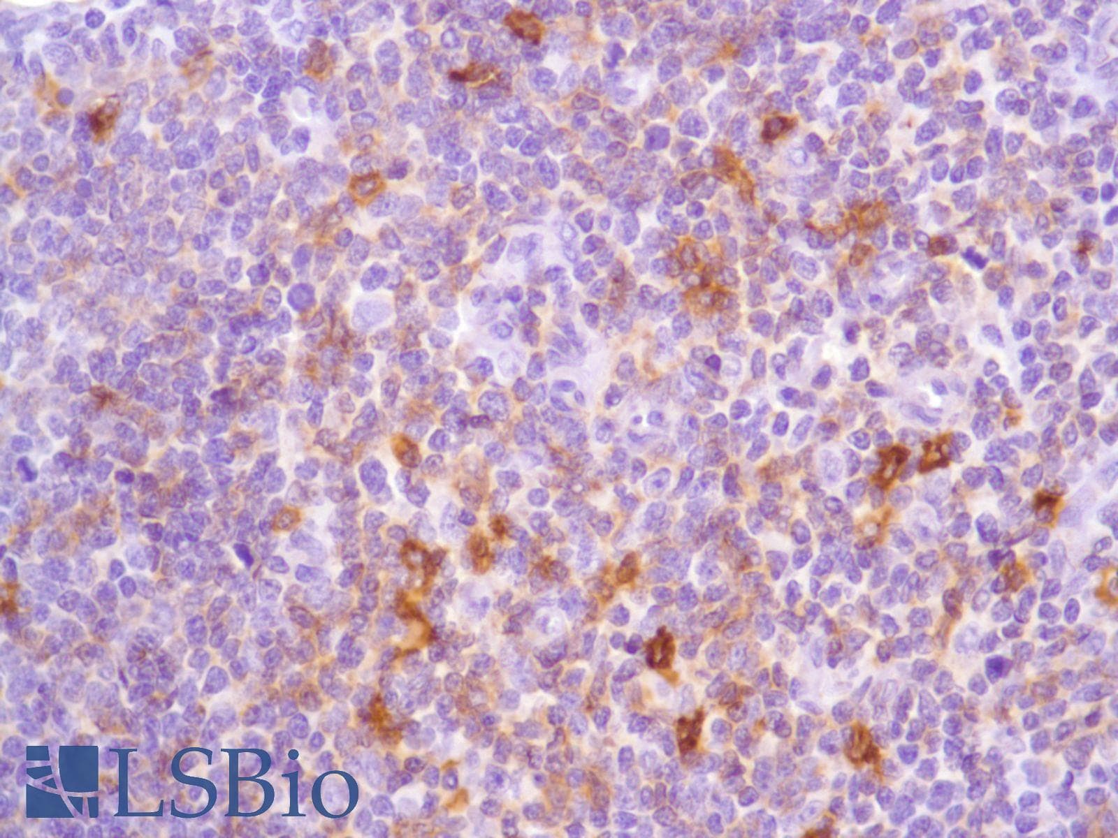 ICOS / CD278 Antibody (C-Terminus, clone SP98)