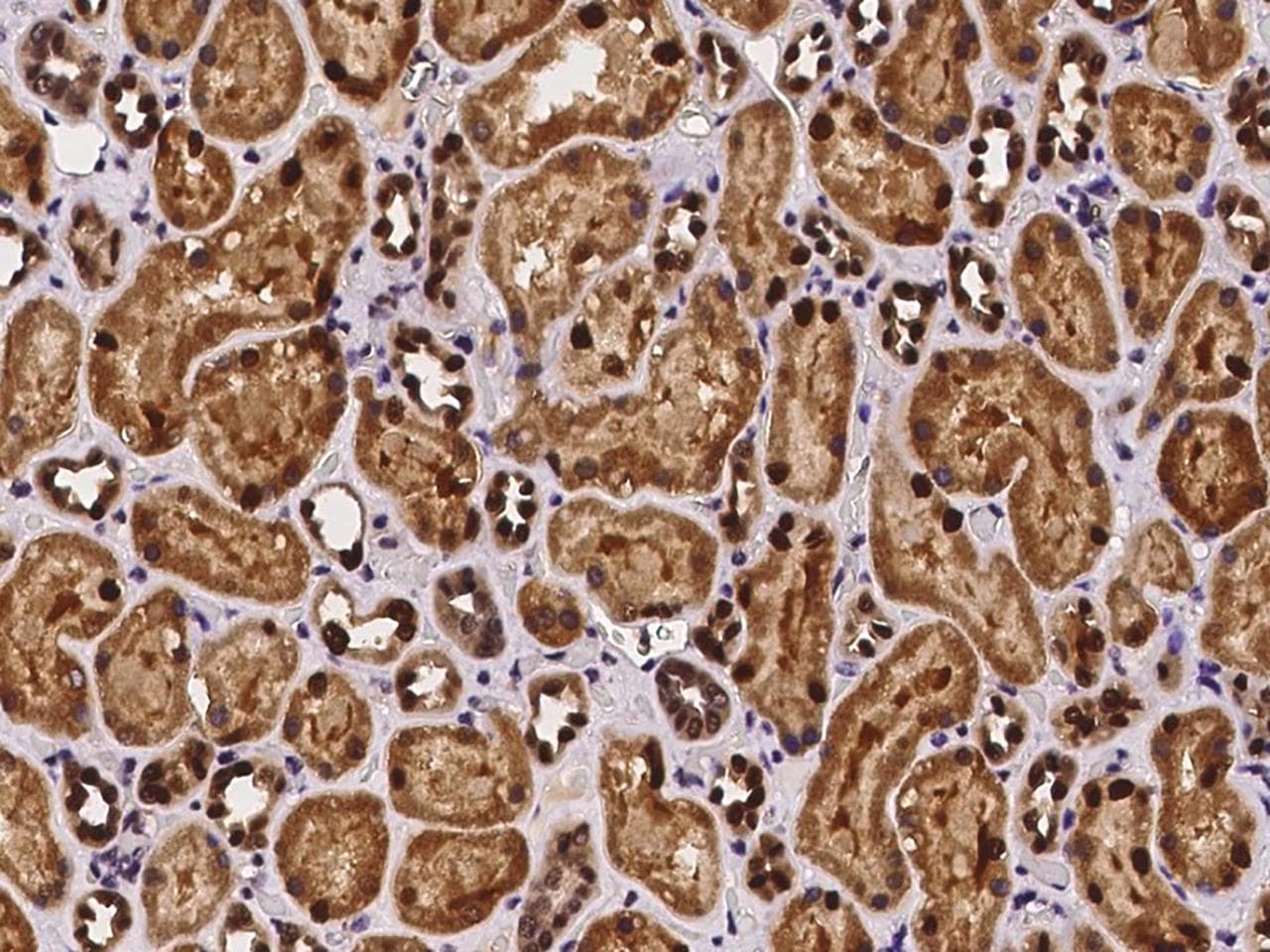 SCLY Antibody