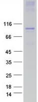Human TRPC3 Protein (Recombinant Myc-DDK (Flag))