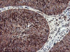 TRAP1 / HSP75 Antibody (clone OTI1A1)