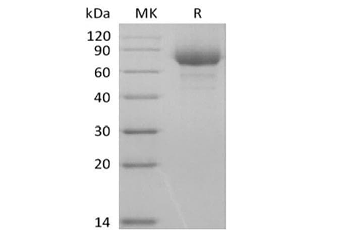Human LILRA3 / CD85e Protein (Recombinant AVI-6His, C-terminus)