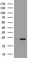 VILIP / VSNL1 Antibody (clone OTI5C8)