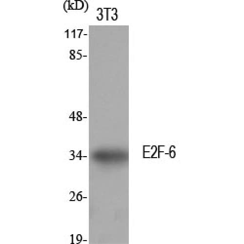 Polyclonal Rabbit anti-Human E2F6 Antibody (110-190 aa, Internal, IHC, WB)