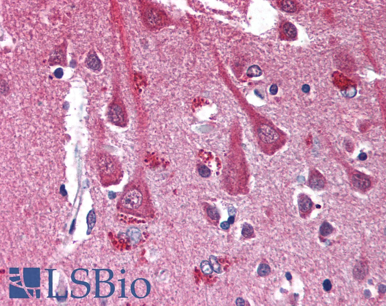 IHC-plus™ CXCR4 Antibody (clone 12G5)