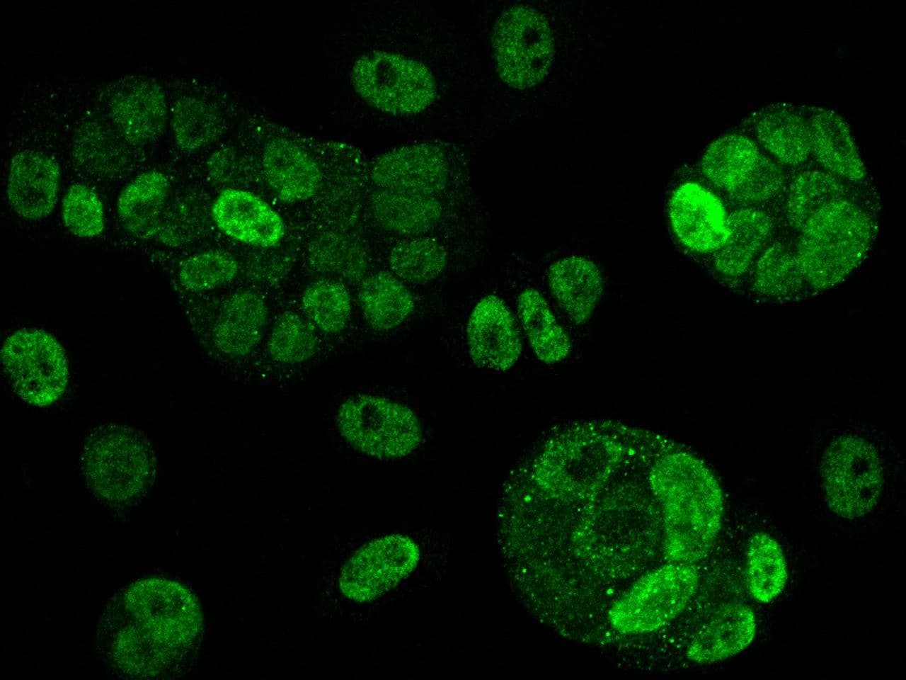 Polyclonal Rabbit anti-Human PRKAA2 / AMPK Alpha 2 Antibody (Preservative Free, IHC, IF)
