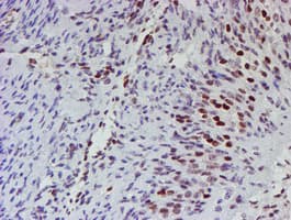 MLF1 Antibody (clone OTI5D9)