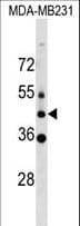 Polyclonal Rabbit anti-Human MLC1 / MLC Antibody (aa337-366, WB)