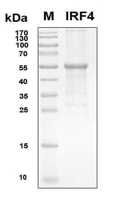 Human IRF4 Protein (Recombinant 6His, N-terminus)