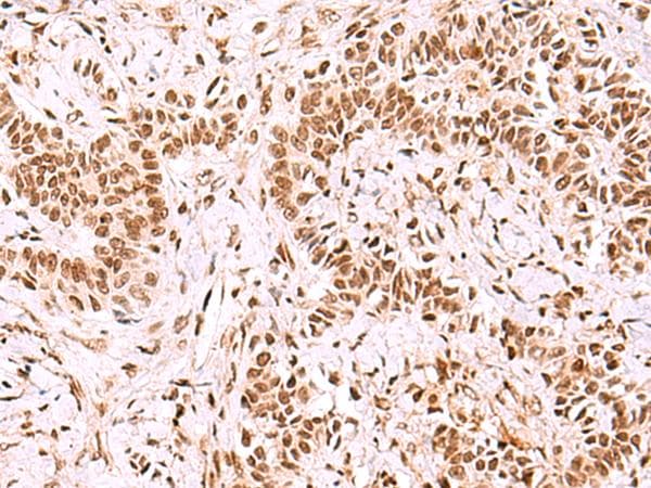GPKOW Antibody