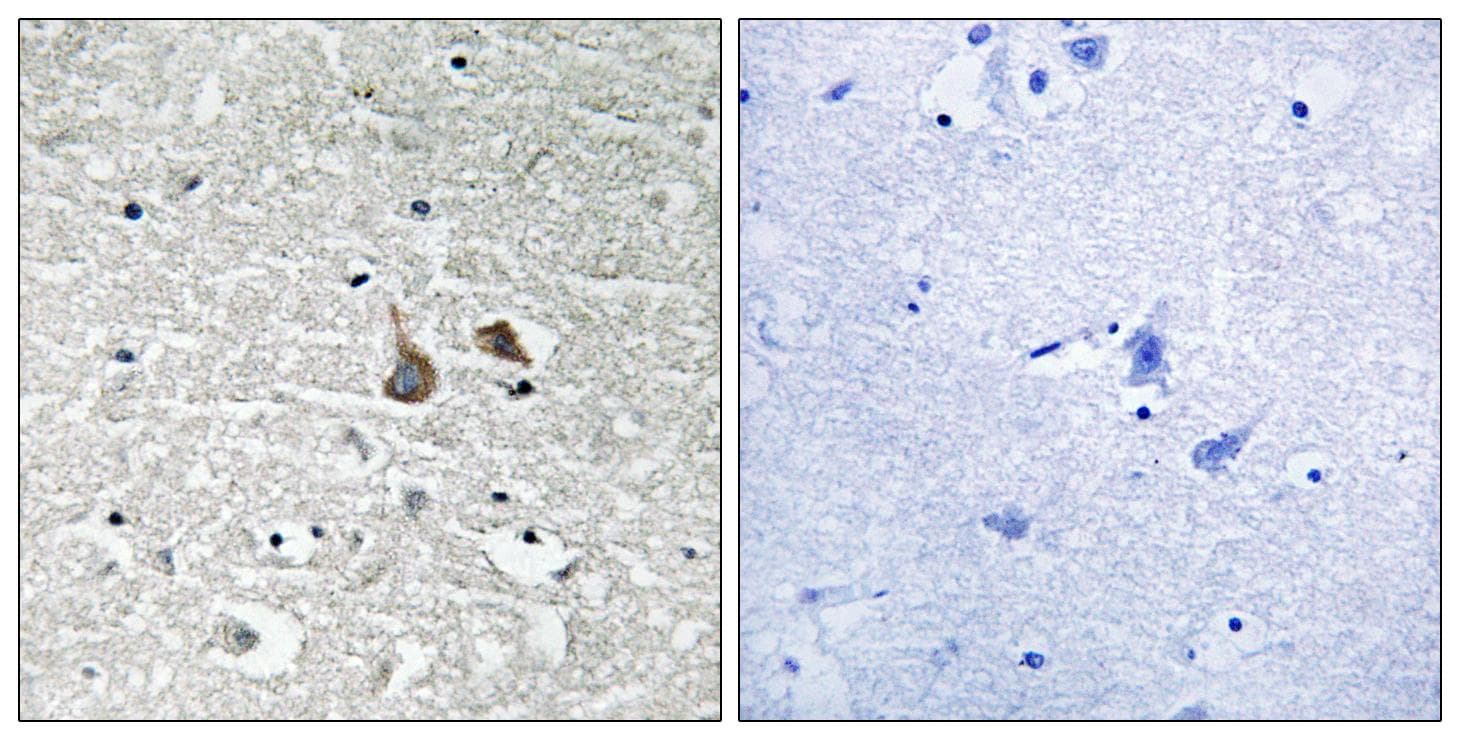 IRAK1 / IRAK Antibody (phospho-Ser376)