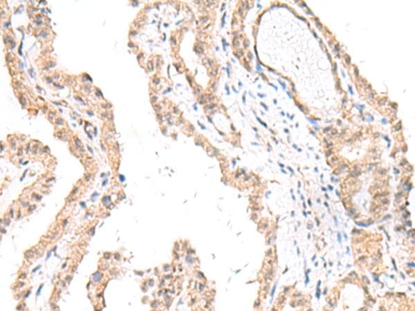 FANCE Antibody