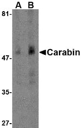 TBC1D10C / CARABIN Antibody
