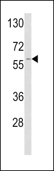 PLAT / TPA Antibody (aa371-399)
