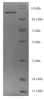 Mouse OSBPL11 Protein (Recombinant 6His-SUMO, N-terminus)