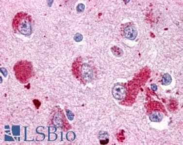 PathPlus™ GPR151 Antibody (C-Terminus)