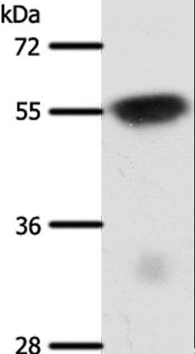 Polyclonal Rabbit anti-Human SLC32A1 / VGAT Antibody (WB)