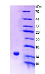 Human RICK / RIP2 Protein (Recombinant His-T7)
