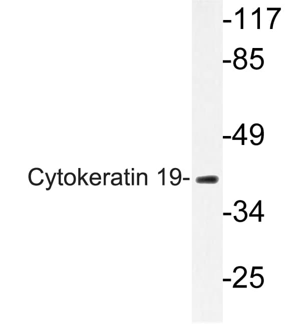 IHC-plus™ KRT19 / CK19 / Cytokeratin 19 Antibody (aa300-349)