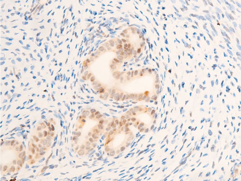 MYC / c-Myc Antibody (phospho-Thr58)