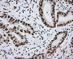 ARNT / HIF-1-Beta Antibody (clone OTI1A1)