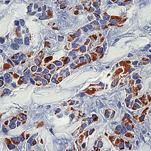 KRT18 / CK18 / Cytokeratin 18 Antibody (clone DC10)