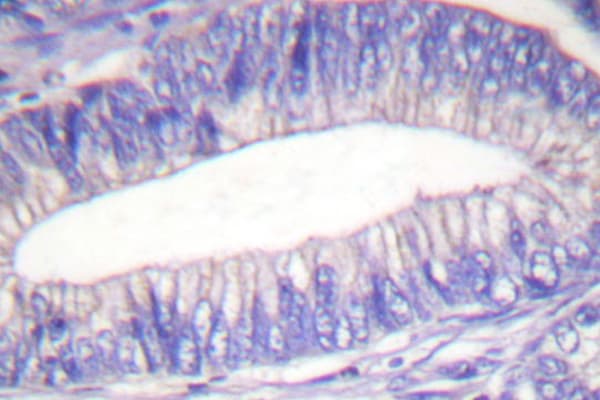 LYN Antibody (Thr501)