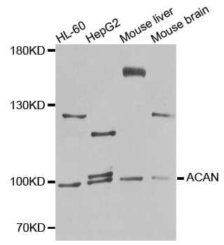 Polyclonal Rabbit anti-Human ACAN / Aggrecan Antibody (WB)