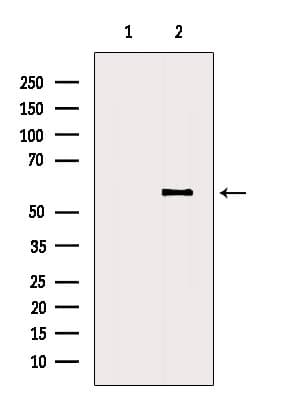 Polyclonal Rabbit anti-Human RASSF10 Antibody (WB)