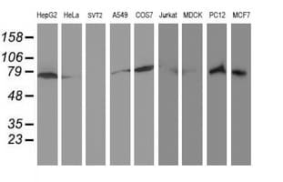 RPN1 / Ribophorin I Antibody (clone OTI3E1, Carrier-free)