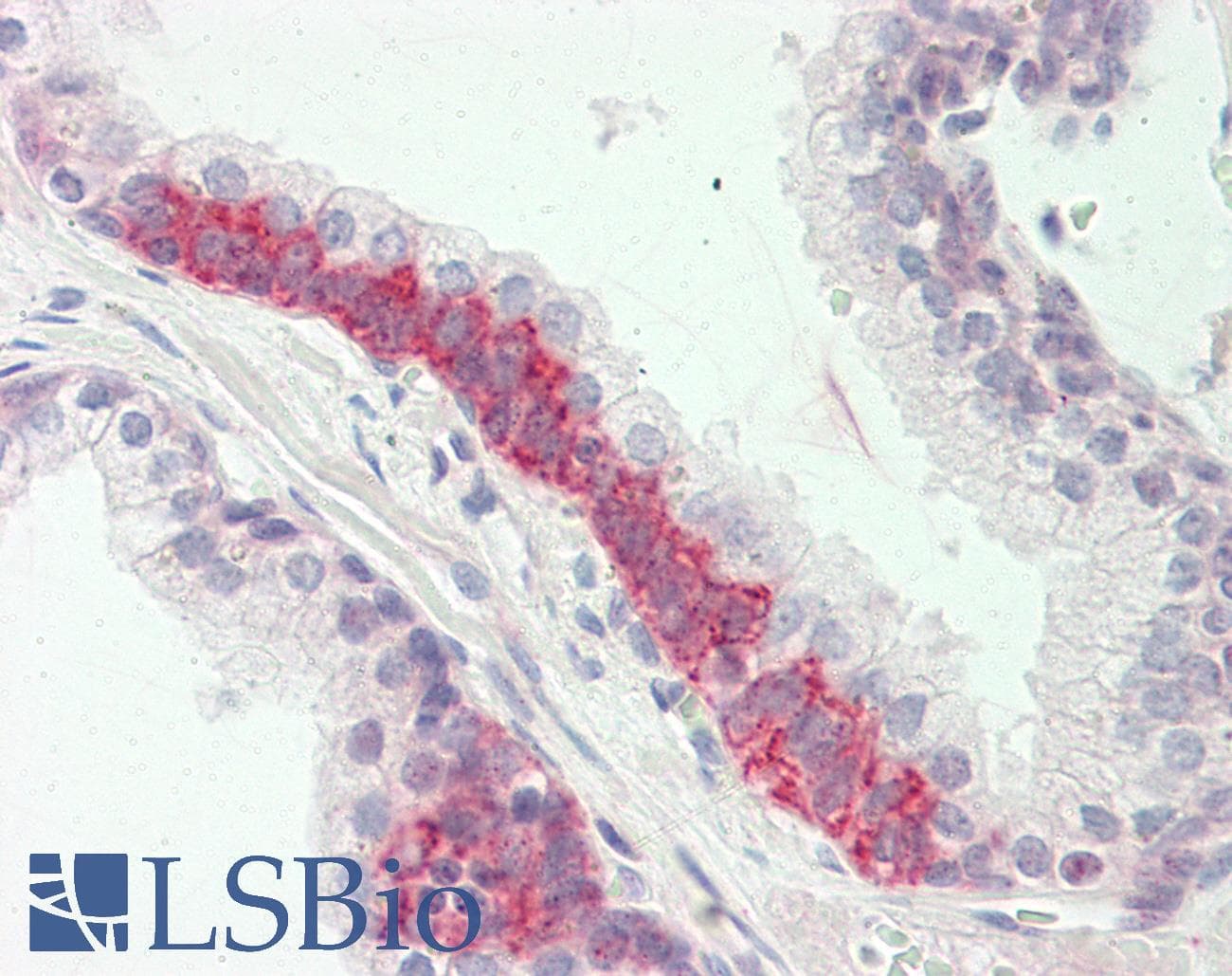 PathPlus™ RBFOX3 / NEUN Antibody