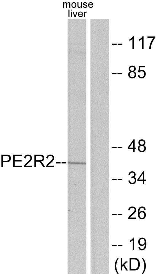 PTGER2 / EP2 Antibody