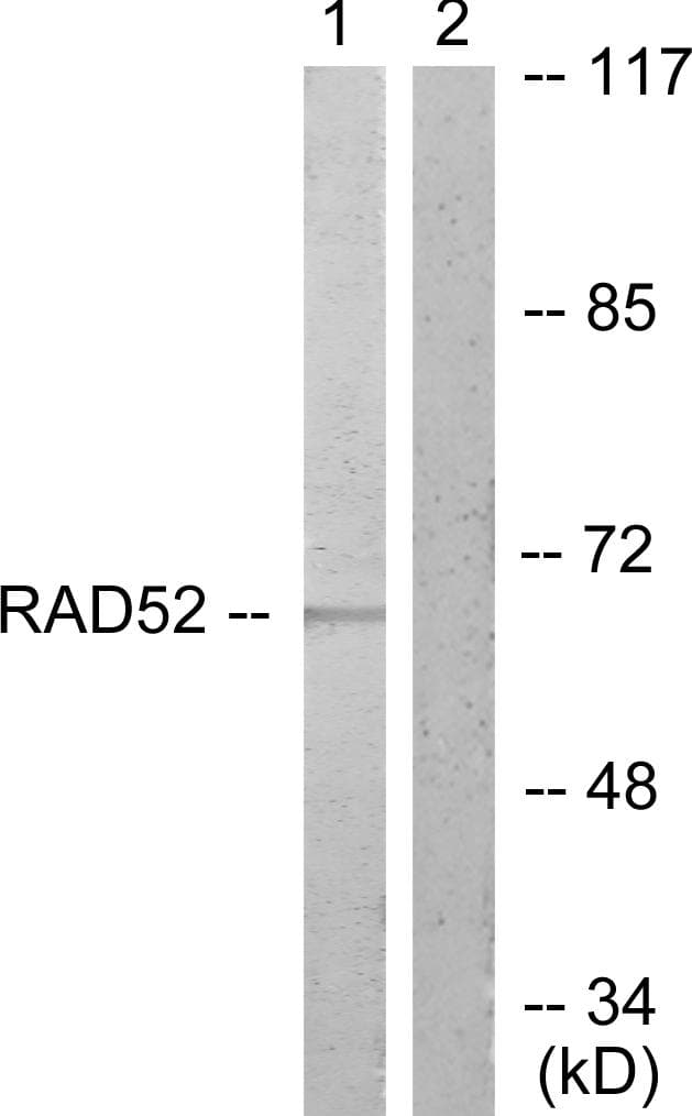 DPYSL2 / CRMP2 Antibody (p514)