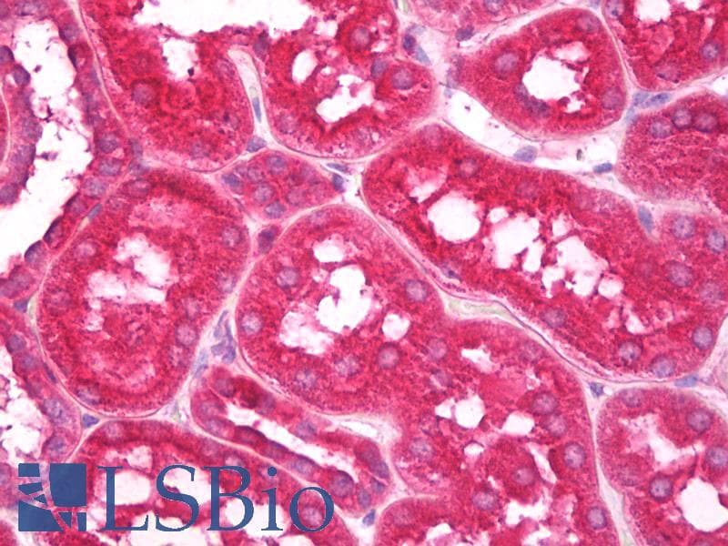 IHC-plus™ Testilin / EHD1 Antibody (Internal, clone EPR4955)