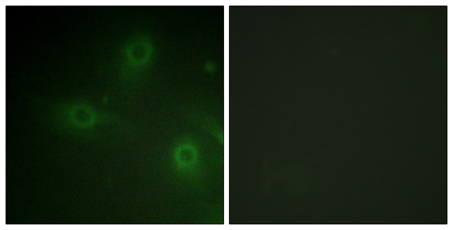 Polyclonal Rabbit anti-Human NCF1 / p47phox / p47 phox Antibody (aa281-330, IF, WB)