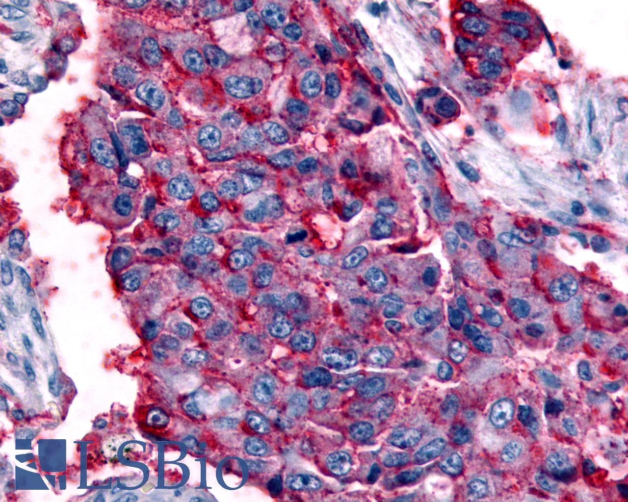 IHC-plus™ Polyclonal Rabbit anti-Human GPR63 Antibody (Cytoplasmic Domain, IHC)