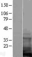 CLP / COTL1 Protein (Over-Expression Lysate Myc-DDK (Flag))