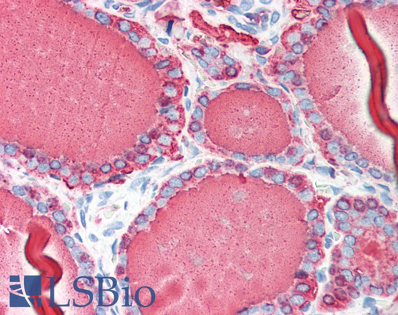 IHC-plus™ TG / Thyroglobulin Antibody (clone 2H11)