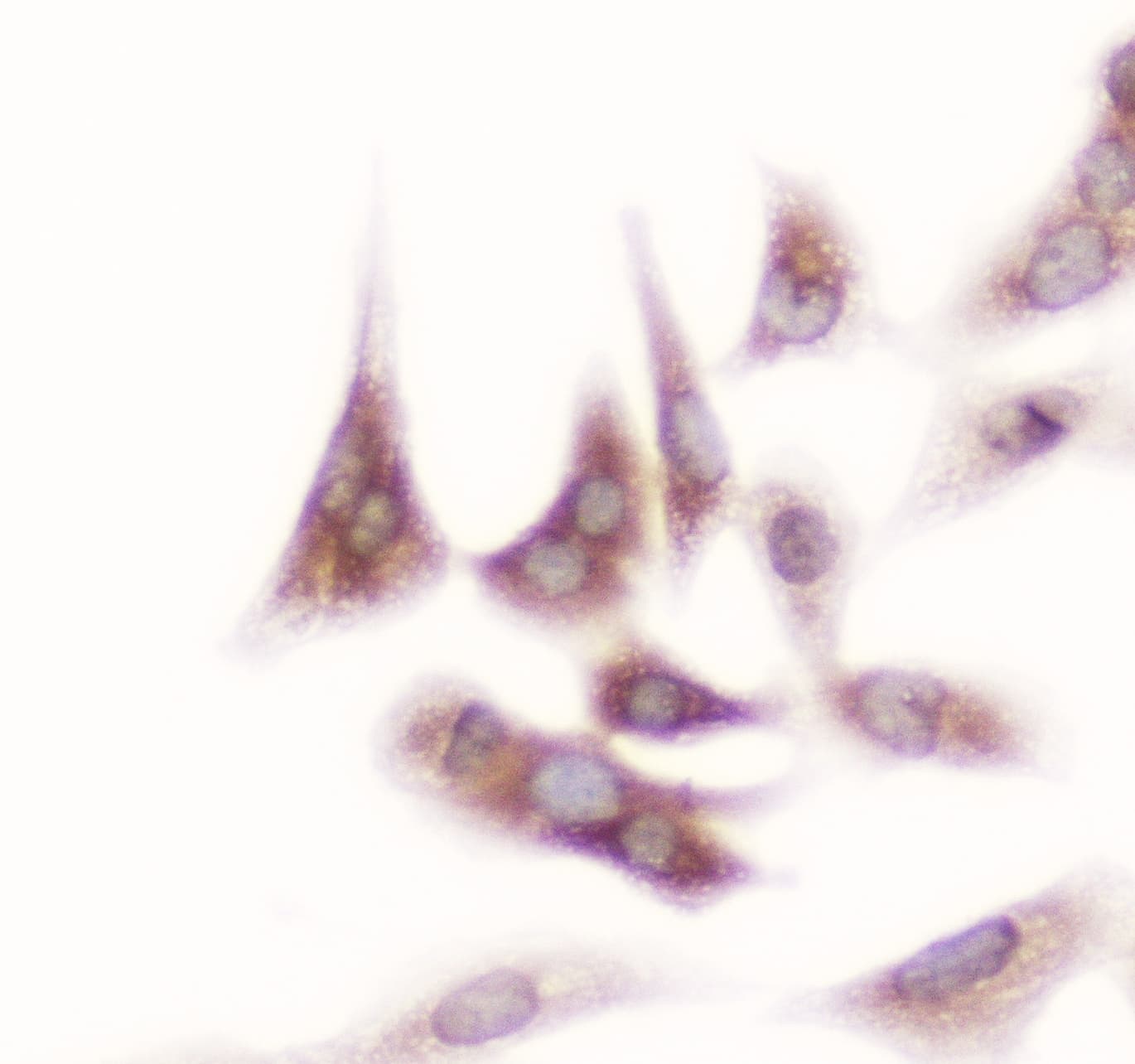 GSR / Glutathione Reductase Antibody
