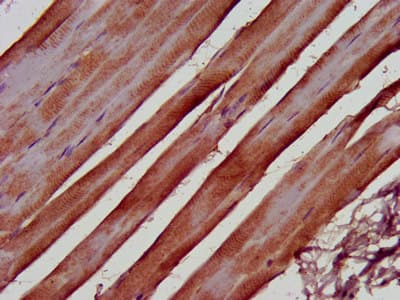 KIND2 / FERMT2 Antibody