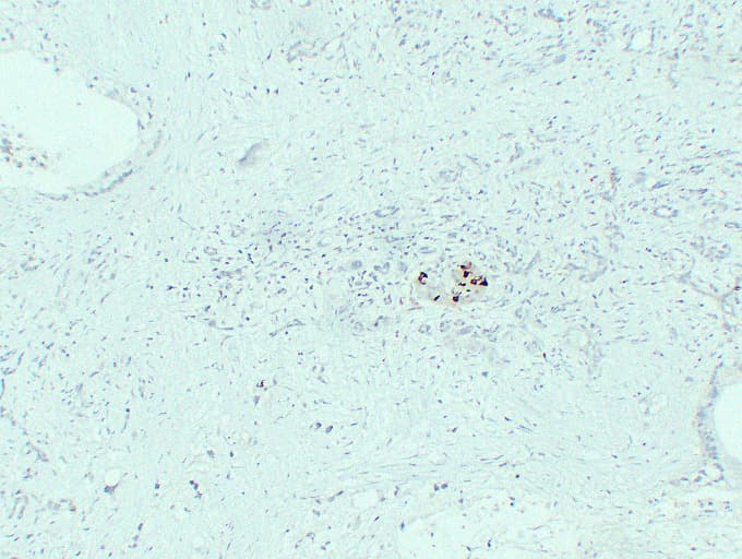 IGF2 Antibody (clone ABT-IGF2)