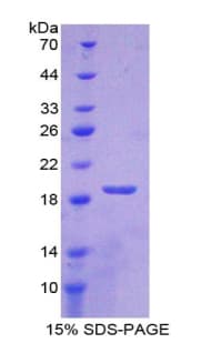 Rabbit SOD1 / Cu-Zn SOD Protein (Recombinant His)