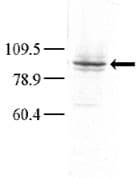 MAP4K3 / GLK Antibody (aa423-453)
