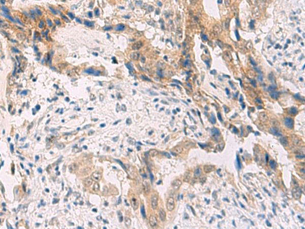 PCYT2 / ET Antibody