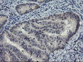 DOK7 Antibody (clone OTI1E7, Carrier-free)