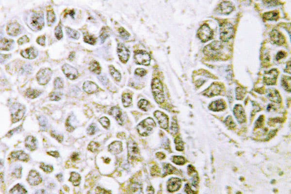 Polyclonal Rabbit anti-Human HNRPM / HNRNPM Antibody (Pro43, IHC, IF, WB)